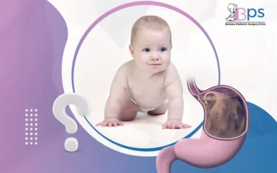 ما أسباب ارتجاع المريء عند الأطفال؟